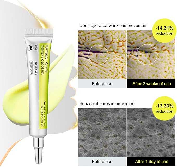 Retinal Shot Tightening Booster | Anti-Aging, Smooths Fine Lines, Boosts Elasticity, Brightens Skin Tone For All Skin Type, 15ML
