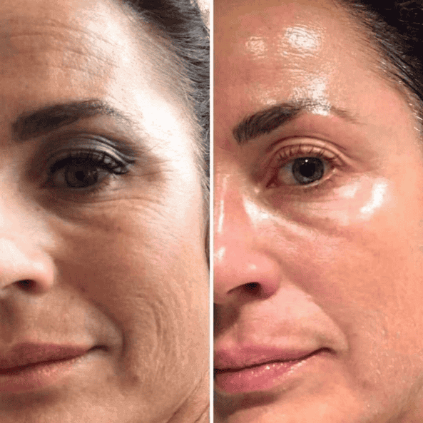 Retinal Shot Tightening Booster | Anti-Aging, Smooths Fine Lines, Boosts Elasticity, Brightens Skin Tone For All Skin Type, 15ML